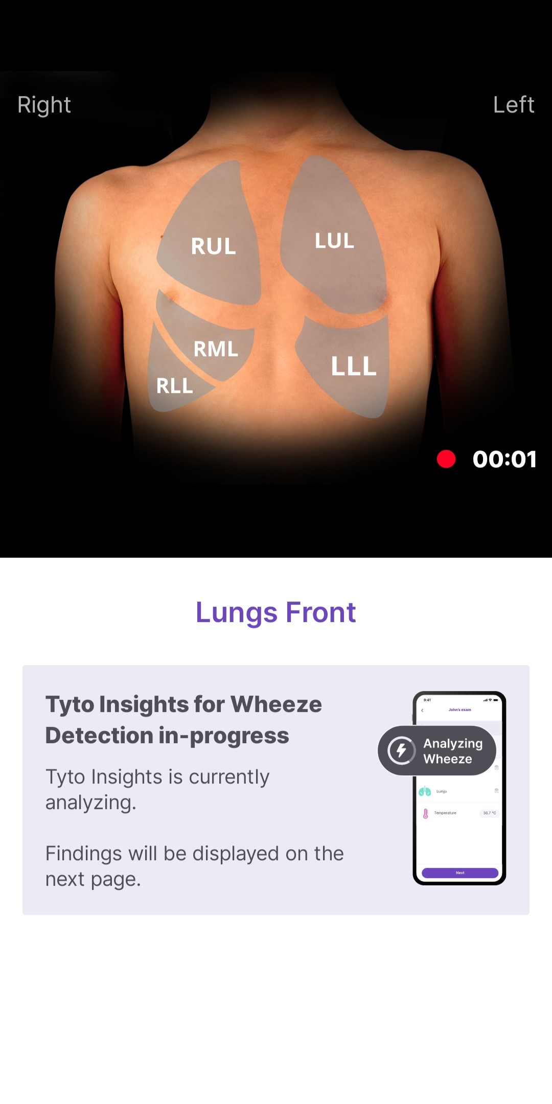 Point of Care Wheeze Analysis